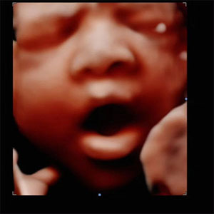4D HD live ultrasound baby