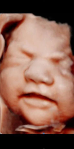 HD ultrasound baby close up