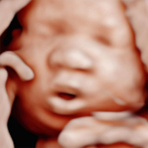 HD live ultrasound rendering